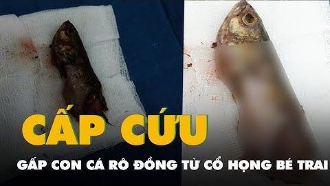 Gắp con cá rô đồng còn sống từ cổ họng bé trai 4 tuổi