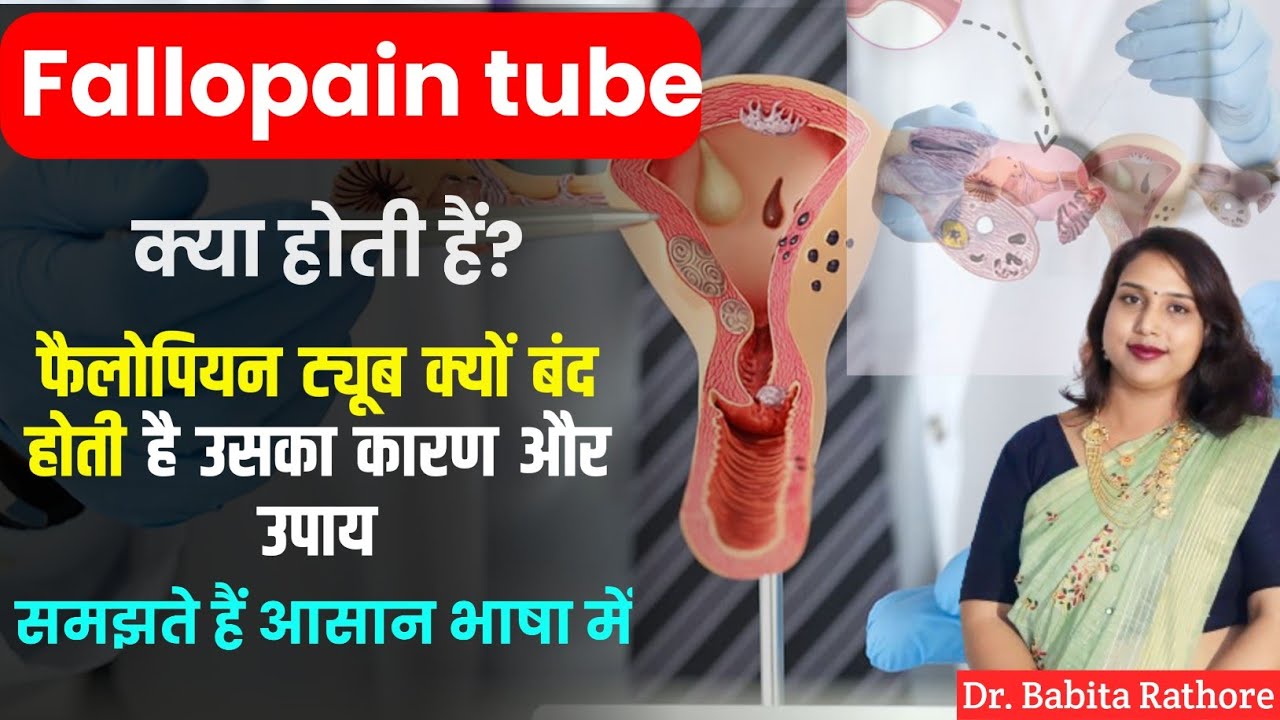 Fallopian tube😭Block रहती है तो उस पर क्या🤔उपाय है? फैलोपियन ट्यूब ब्लॉक🤰होने पर क्या करना चाहिए