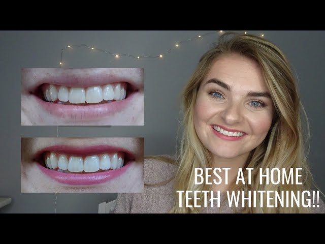 HOW I WHITENED MY TEETH AT HOME | *DISCOUNT CODE*