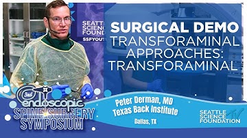 Transforaminal  Approaches: Transforaminal - Peter Derman, M.D.