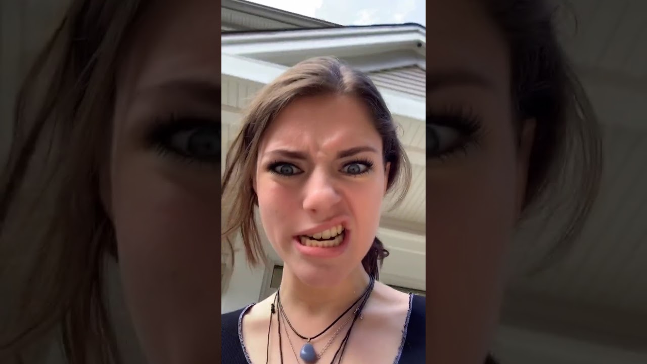 Person laughing after dental work because half of face is numb.