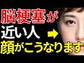 【医師監修】見逃すと危険な「脳梗塞が近い人だけに起こる顔の異変」