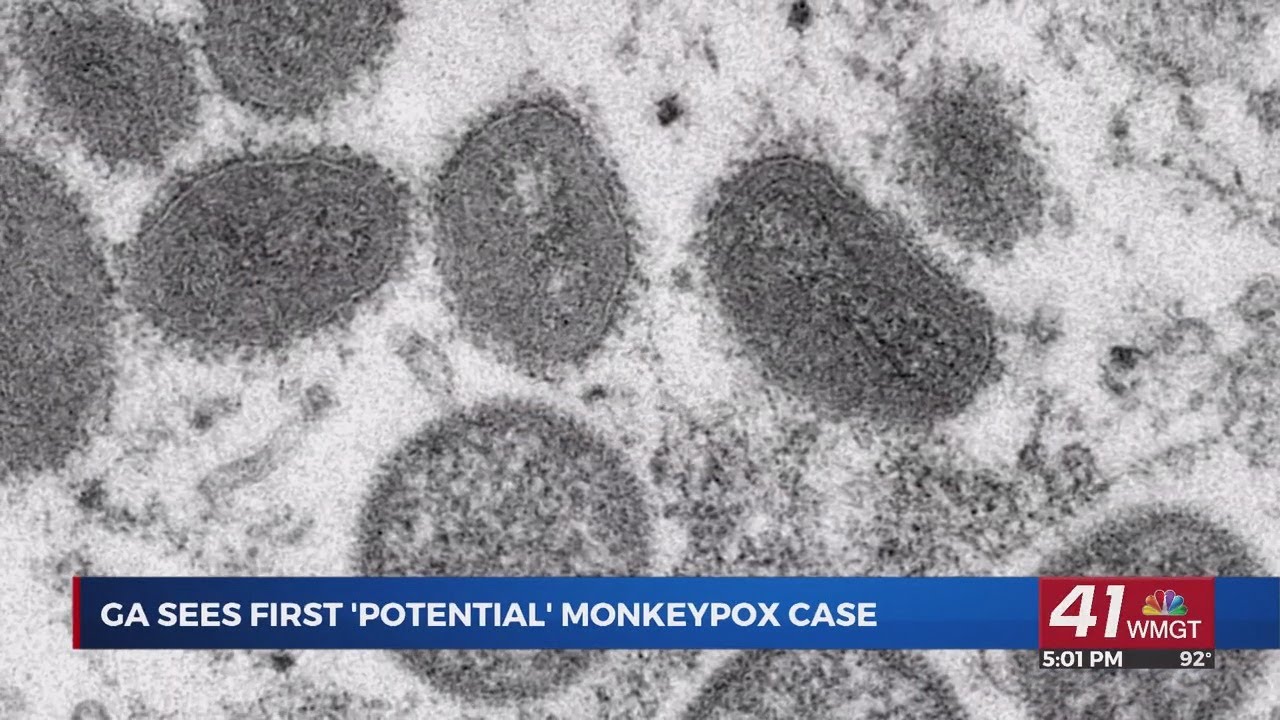 First potential case of Monkeypox in Georgia discovered - YouTube