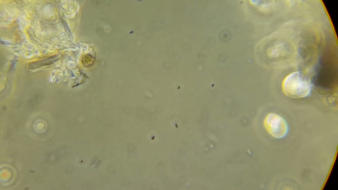 20250815 AC Cleaning Liquid Under Microscope - fast Running Bacteria