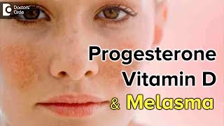 Can Progesterone & Vitamin D deficiency cause Melasma? - Dr. Rasya Dixit