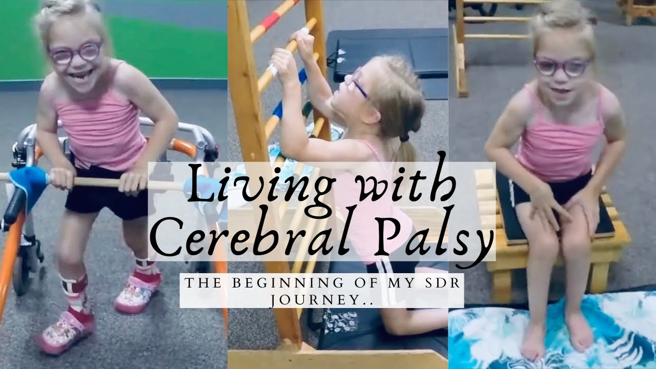 MY ABILITIES BEFORE SURGERY | SDR SURGERY JOURNEY | DAY IN THE LIFE