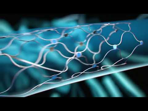This brain-computer interface can be implanted without cutting the skull | Synchron | Stentrode