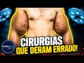 10 Cirurgias Plásticas que Viraram Pesadelos
