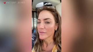 Famous The reason why I had plastic surgery Wealth