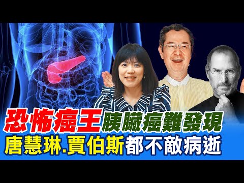 巴戈病逝 "恐怖癌王"胰臟癌難發現 唐慧琳.賈伯斯也不敵 徵兆細微! 一不注意癌細胞跑得比時間快 @中天新聞CtiNews