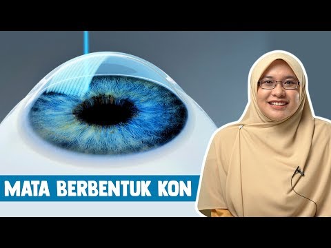 Video: Apakah yang berbentuk kon?