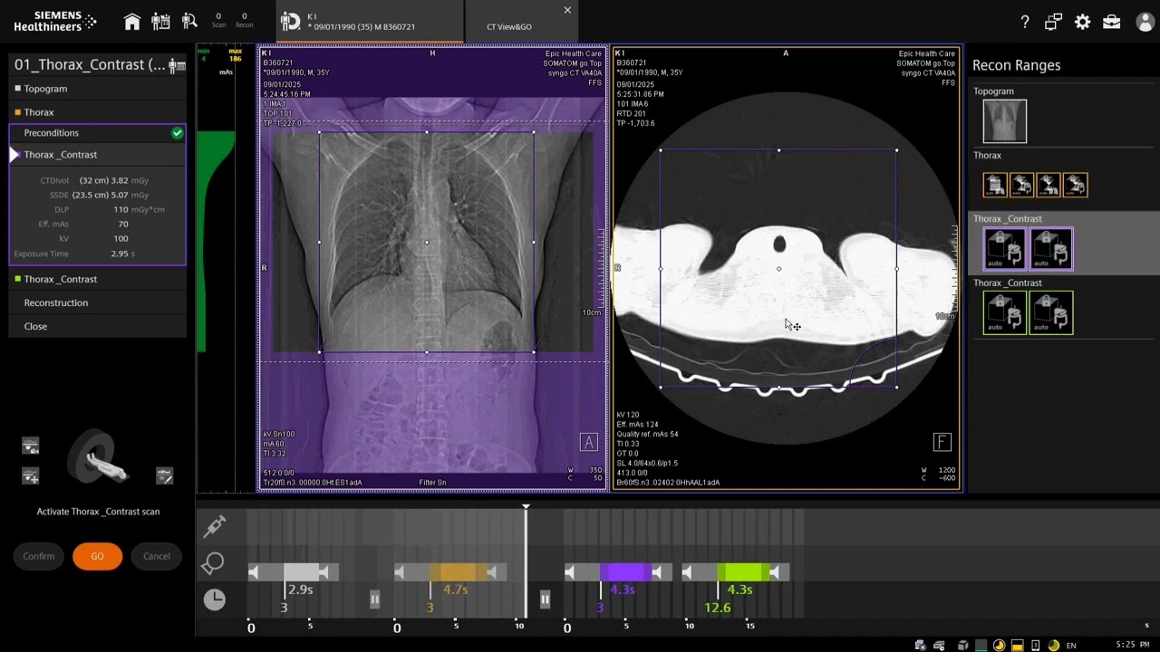 CT scan chest with contrast Technique || How to do CT scan chest in Siemens Somatom Go Top 