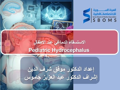 استسقاء الدماغ في الأطفال ||  Peadiatric Hydrocyphalus