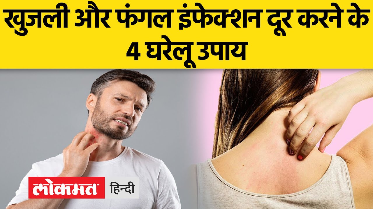 Itching and Fungal Infection Home Remedies। तुलसी और नारियल के तेल से