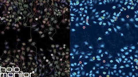 Studying wound healing together with Single Cell Tracking Assay | HoloMonitor®