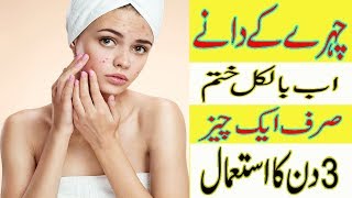 Chehre Ke Dano Ka Ilaj in Urdu | Beauty Tips in Urdu