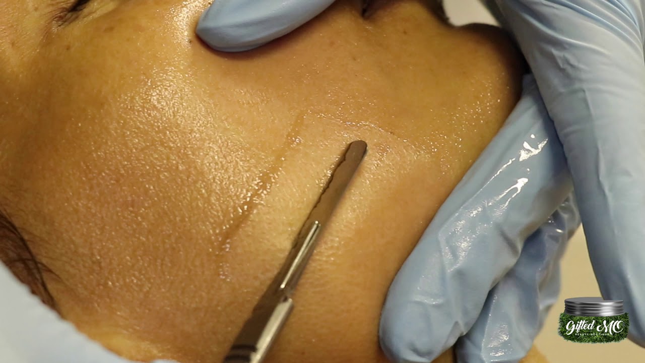 DermaPlaning Facial Hair Removal, Glow + Exfoliation