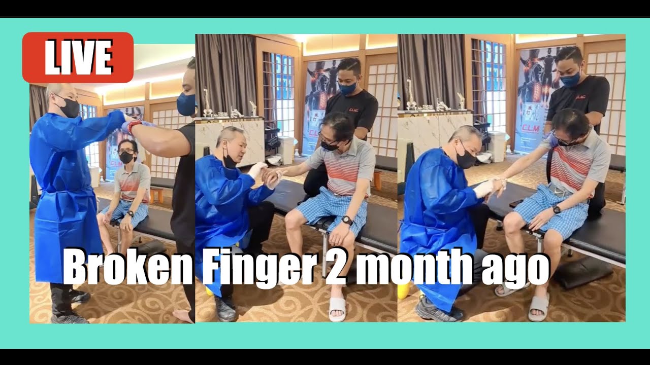 Broken Finger 2 month ago still Misalignment Problems how adjust by