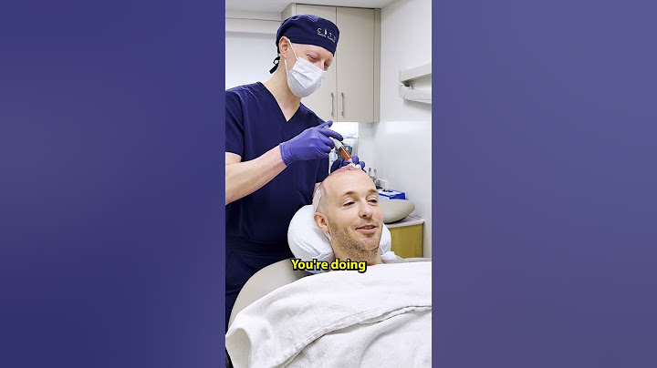What's It Like To Get A Hair Transplant?