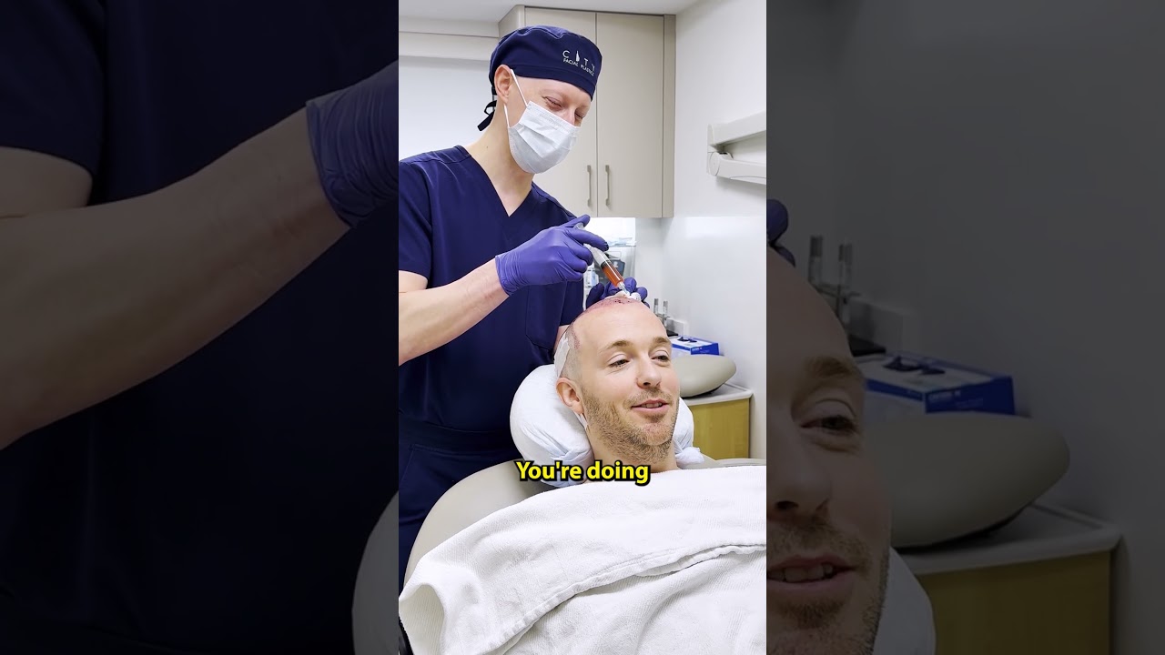 What's It Like To Get A Hair Transplant?