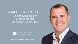 Arm Lift & Thigh Lift  A difficult problem for patients after significant weight loss