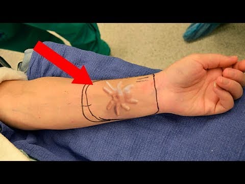 СУЩЕСТВА, НАЙДЕННЫЕ ЖИВЫМИ ВНУТРИ ЧЕЛОВЕЧЕСКОГО ТЕЛА