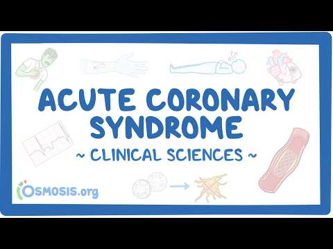 Acute Coronary Syndrome: Clinical Sciences