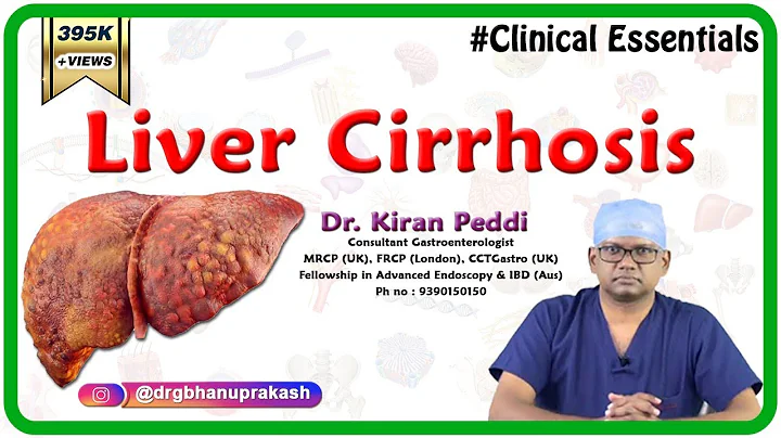 Liver Cirrhosis (Clinical essentials) - Dr. Kiran Peddi MRCP(UK), FRCP(London), CCT(Gastro) - DayDayNews