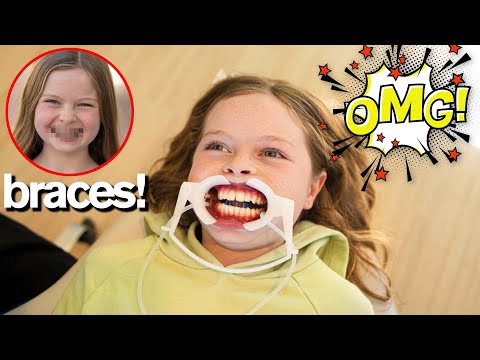 MY DAUGHTER GETS BRACES