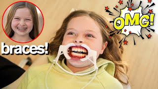 MY DAUGHTER GETS BRACES MY DAUGHTER GETS BRACES