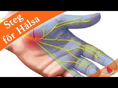 Video: Artrit I Fingrar Och Händer - Orsaker, Symtom Och Behandling. Gymnastik För Artrit I Händerna