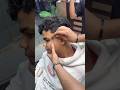 ازالة الحباية المتسلطنة م الوجه   النظافه    