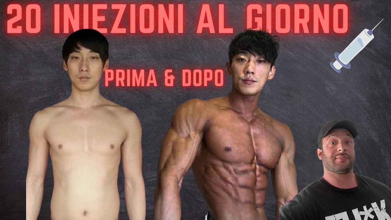 Come l'abuso di steroidi ha colpito questo BB coreano
