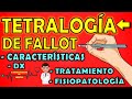 TETRALOGÍA DE FALLOT | Características, Fisiopatología, Crisis Hipóxicas, Diagnóstico, Tratamiento 📝