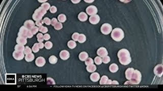 CDC expressing concern about rapidly growing fungus, now in Pennsylvania