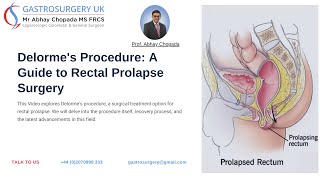 Delormes Procedure Expert Guide To Rectal Prolapse Surgery Dr. Abhay Chopada Gastrosurgery Uk