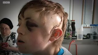 BBC: Jewish teenager suffers life-threatening injuries in brutal attack.