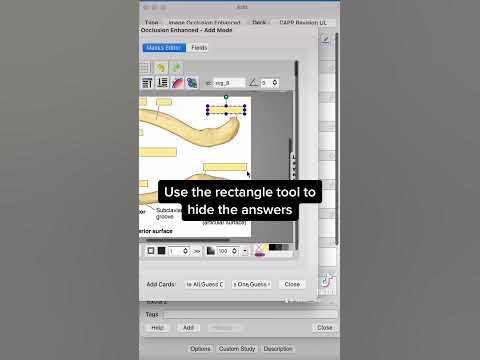 HOW TO STUDY ANATOMY: ANKI image occlusion - YouTube