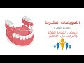 تسجيل العلاقة الفكية والتركيب على المطبق طبيب أسنان استثنائي تسجيل العلاقة الفكية والتركيب على المطبق طبيب أسنان استثنائي