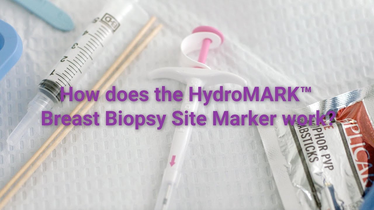 How The HydroMARK Breast Biopsy Site Marker Works YouTube how-the-hydromark-breast-biopsy-site-marker-works-youtube