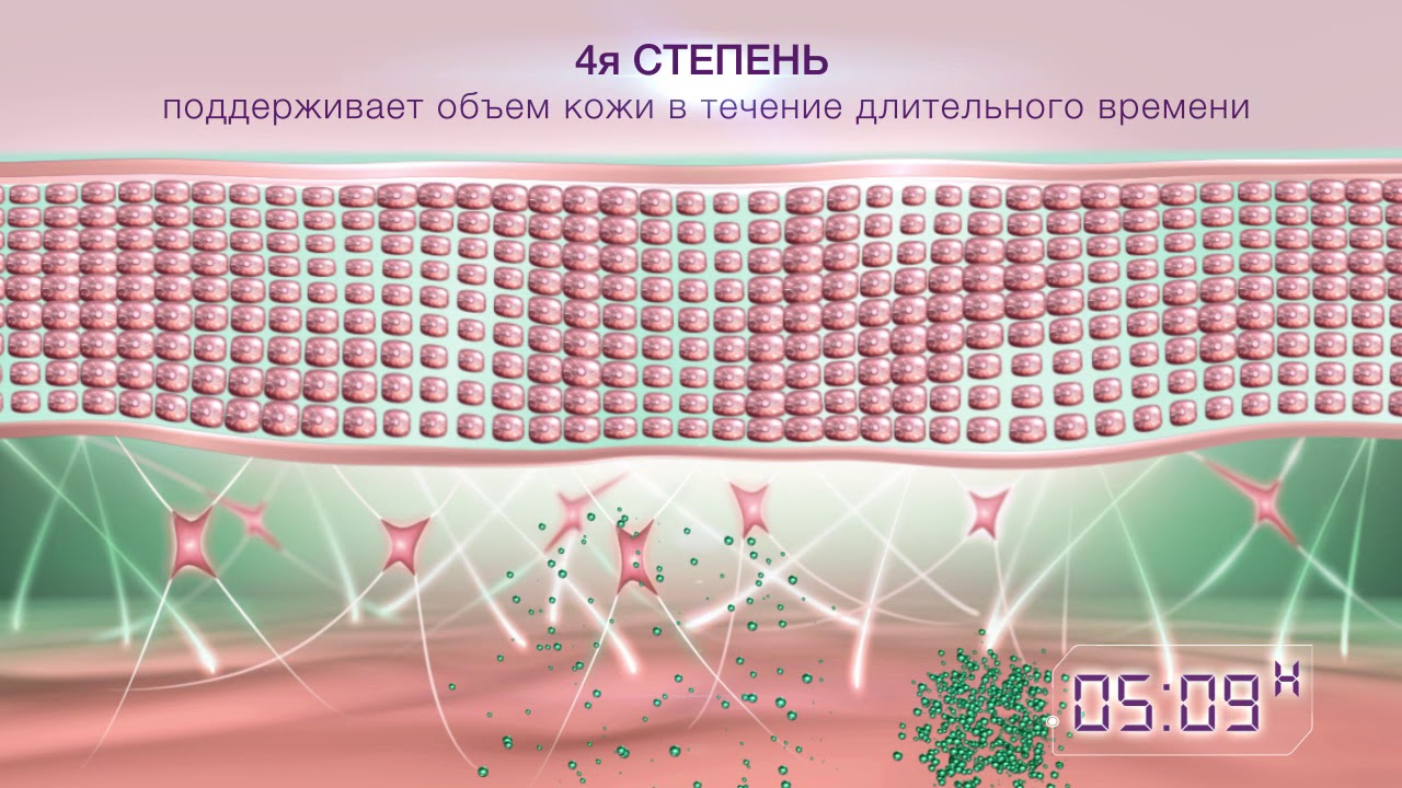 HYALURIDES LP - ИННОВАЦИЯ ПРОТИВ МОРЩИН 2017