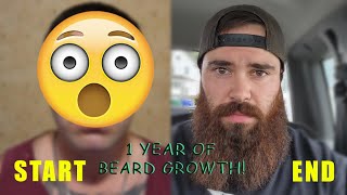 1 YEAR BEARD GROWTH (TIME-LAPSE)