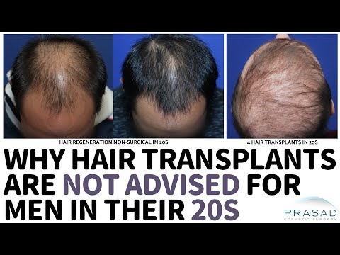 Why Hair Transplants are Not Advised for Men in their 20s