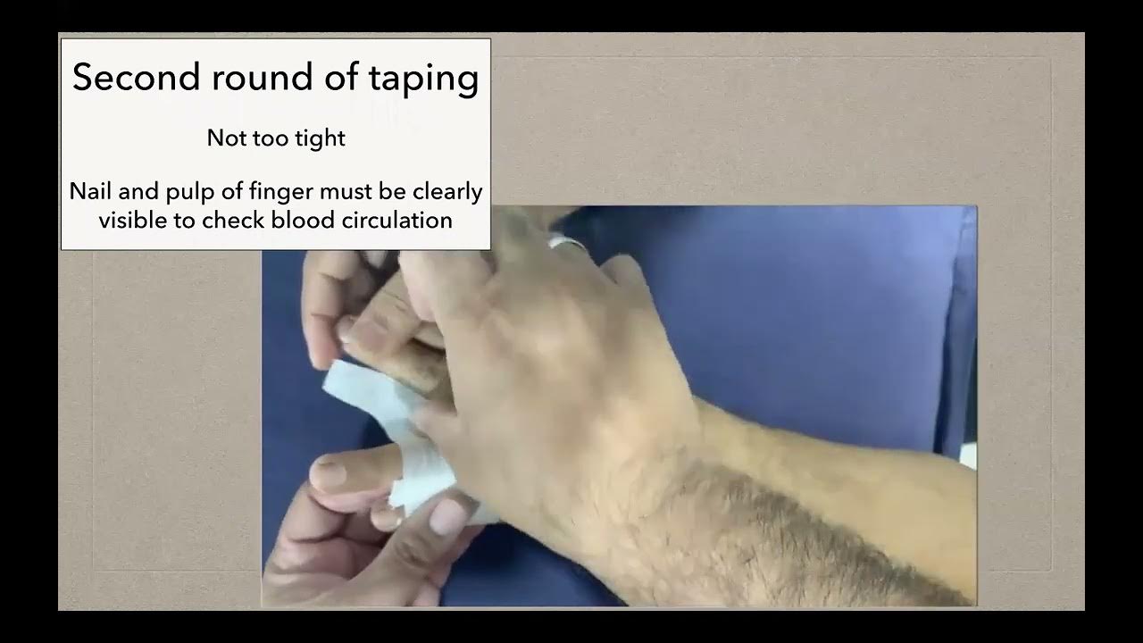 Buddy tapingbuddy strapping technique YouTube