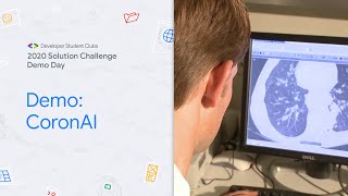 Solution Challenge Demo Day 2020 Project: CoronAI