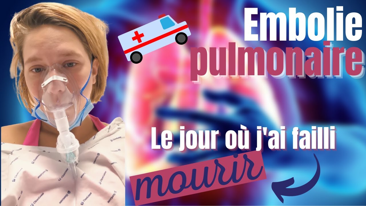 Embolie pulmonaire | Le jour où j'ai failli mourir | témoignage