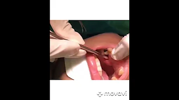 ЛИЧИНКИ ВО РТУ!ВАШИ ПРЕДПОЛОЖЕНИЯ?|BULBS IN THE Mouth! YOUR ASSUMPTIONS?