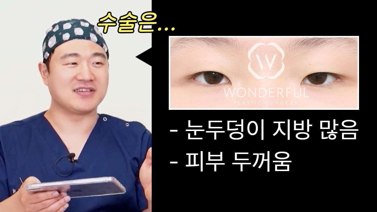 [Вондэрфүл Гоо Заслын Эмнэлэг] Давтан мэс заслын сул тал? Эрэгтэйчүүдийн мэс засал..? Таны асуултад бүрэн хариулна! | Гоо сайхны мэс заслын Асуулт Хариулт l Вондэрфүл ОНЭЙР