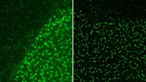 Huygens deconvolution