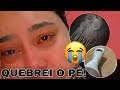 QUEBREI MEU PÉ!!! Afastamento do serviço + tenho dois bebês e sem rede de apoio ( PREOCUPADA)